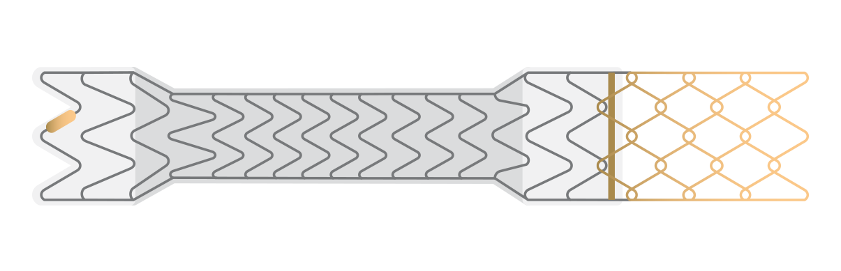 A flat diagram showing GORE® VIATORR® TIPS Endoprosthesis with Controlled Expansion