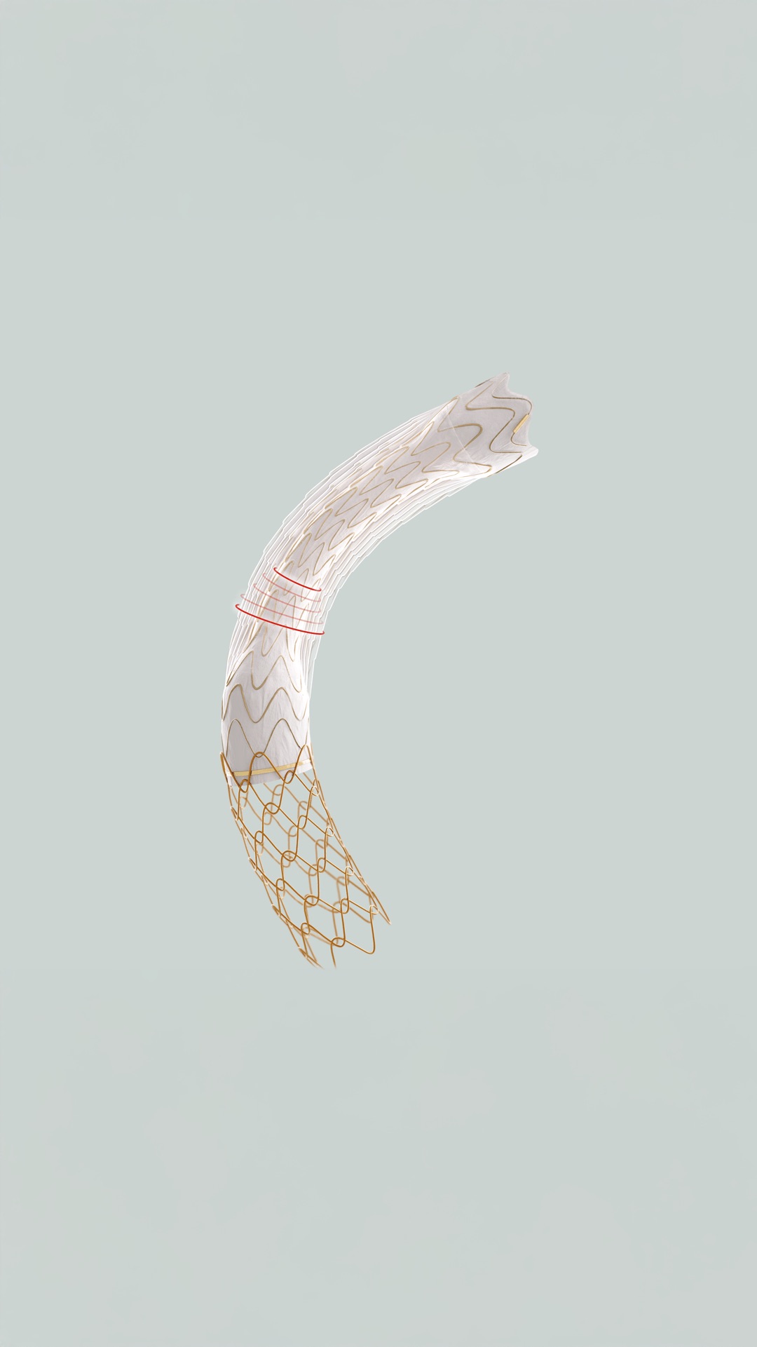 Product shot of GORE® VIATORR® TIPS Endoprosthesis with Controlled Expansion