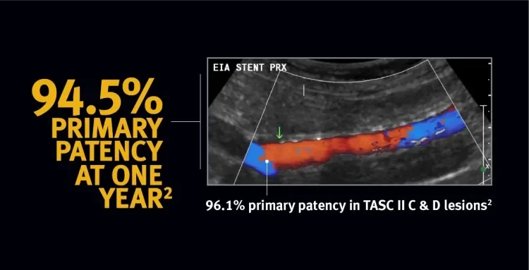 94.5% primary patency