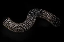 GORE TIGRIS Vascular Stent