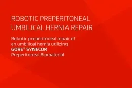 Text reads: Robotic Preperitoneal Umbilical Hernia Repair