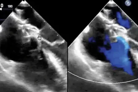 X-ray images of ASDs