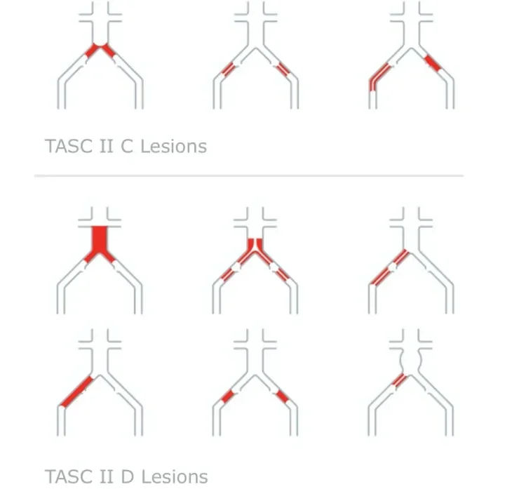 Lesions