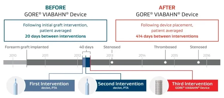 before and after data