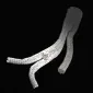 GORE® EXCLUDER® Iliac Branch Endoprosthesis