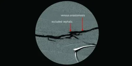 angiogram