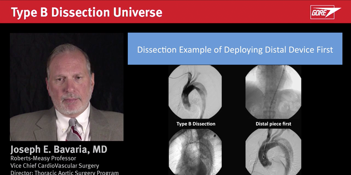 The Conceptual Type B Dissection Universe - Chapter 4 | Gore Medical Europe