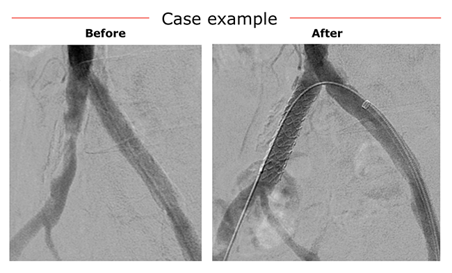 Cases example VBX common