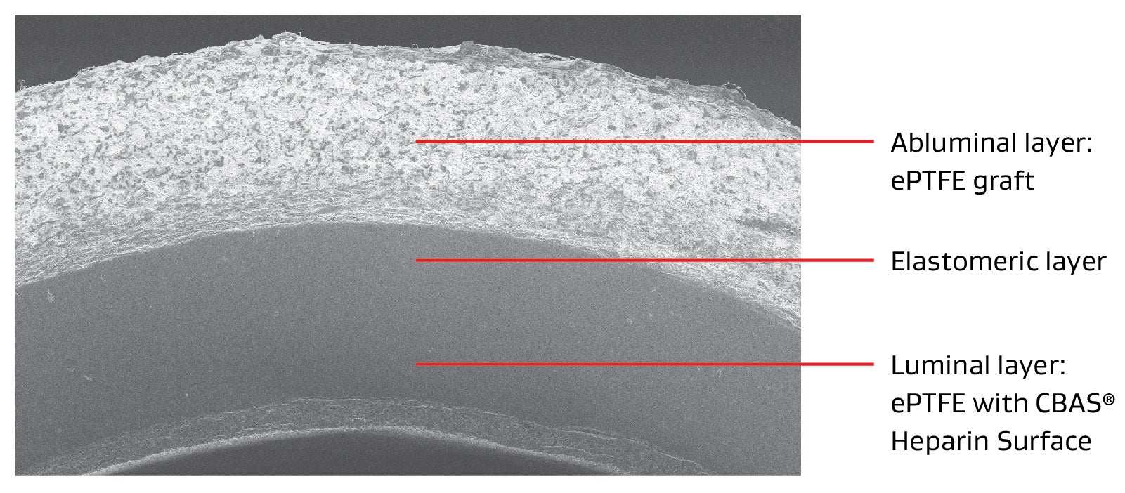 Image showing the tri-layer design of the GORE ACUSEAL Vascular Graft. Abluminal layer (ePTFE graft). Elastomeric layer. Luminal layer (ePTFE with CBAS Heparin Surface)