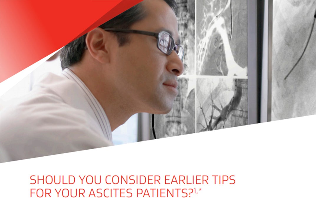 Should you consider earlier TIPS for your patients with ascites?