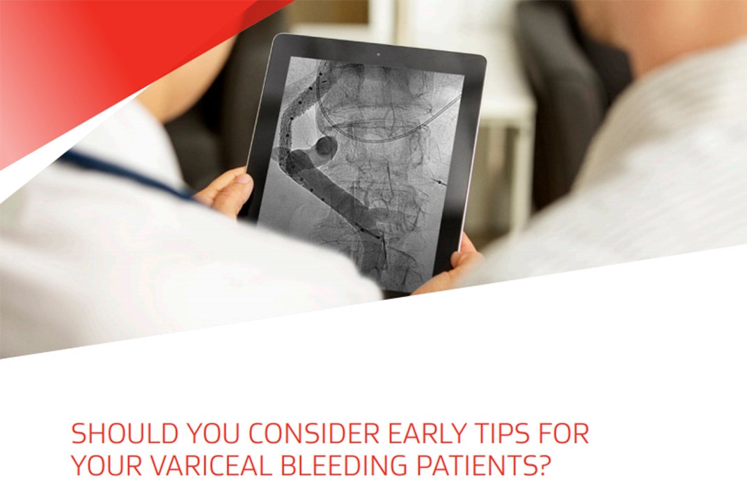 Should you consider earlier TIPS for your patients with variceal bleeding?