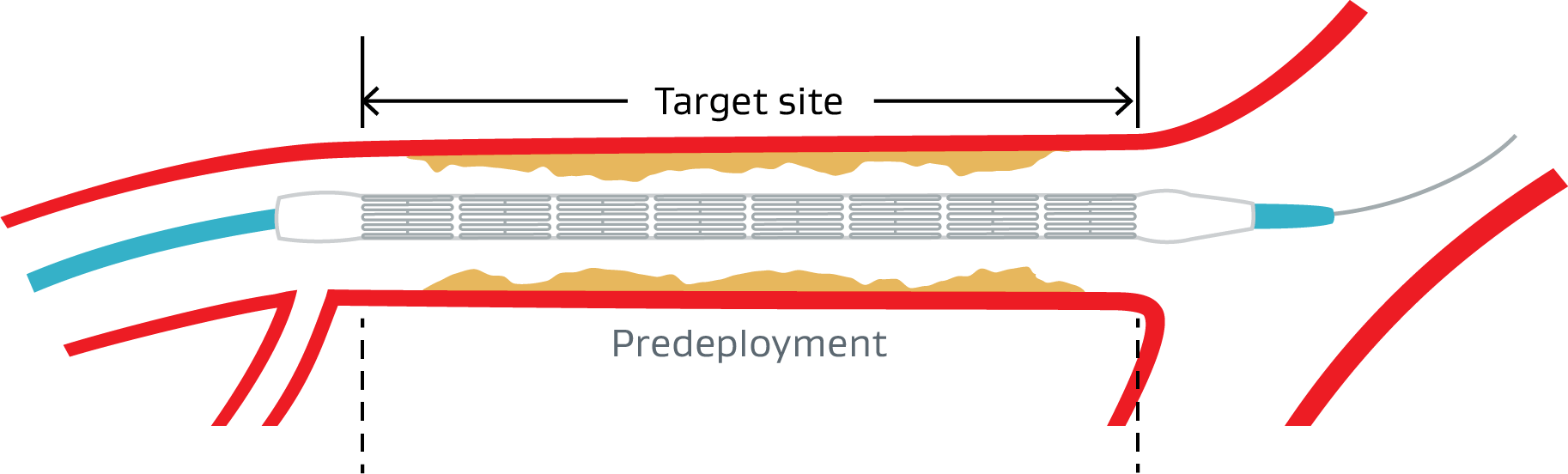 vbx-graphic-pre-deployment