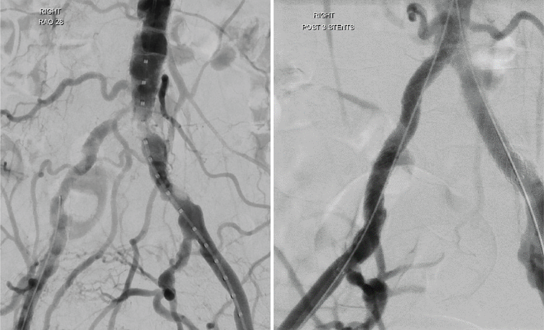 Before and after x-ray