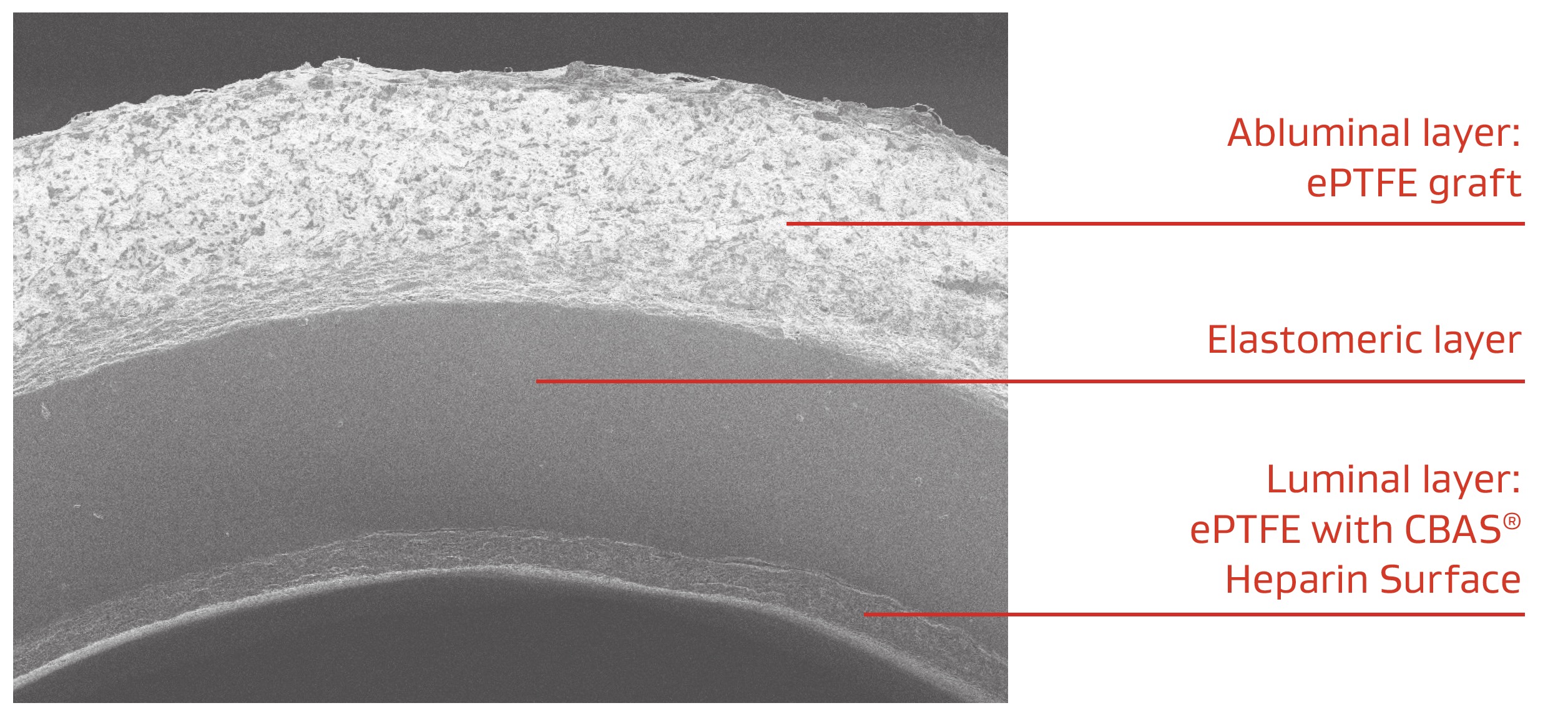 black and white image showing layers of material related to acuseal vascular graft