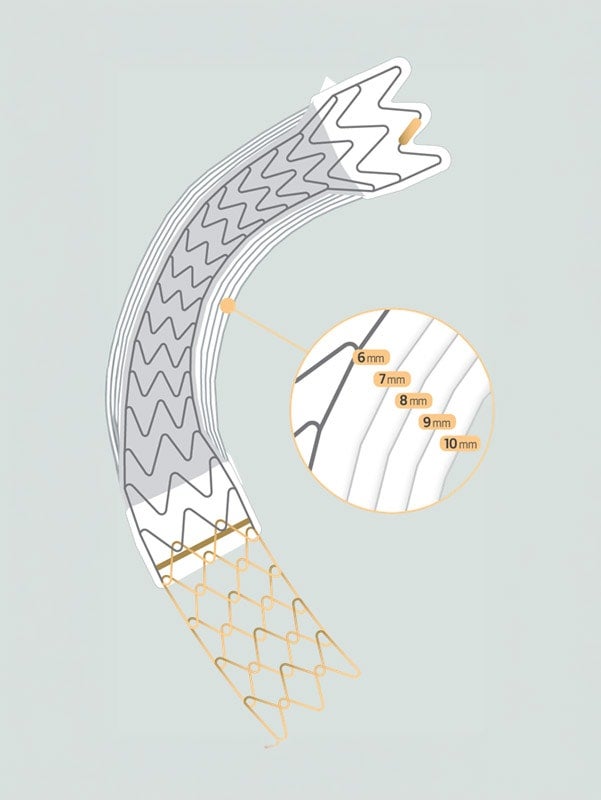 Illustration of a curved covered stent graft with an uncovered metal mesh extension. An inset magnifies the graft and labels selectable expansion diameters of 6 mm, 7 mm, 8 mm, 9 mm, and 10 mm.