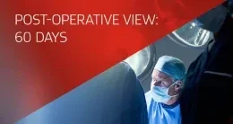 Healthcare professionals in an OR setting with a video title “Post-Operative View: 60-Days.”