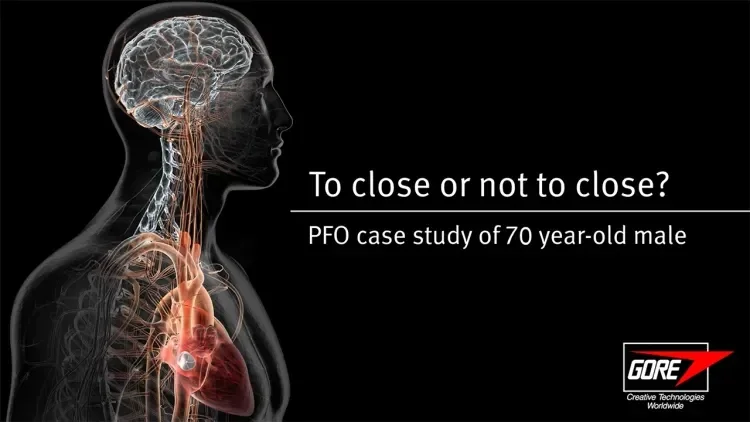 PFO stroke case study of a 70 year old