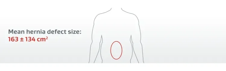 Illustration of a person's torso on a gray background with a red circle on the abdomen indicating the mean hernia defect size: 163 +/- 134 cm squared.