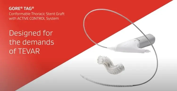 GORE® TAG® Conformable Thoracic Stent Graft with ACTIVE CONTROL 