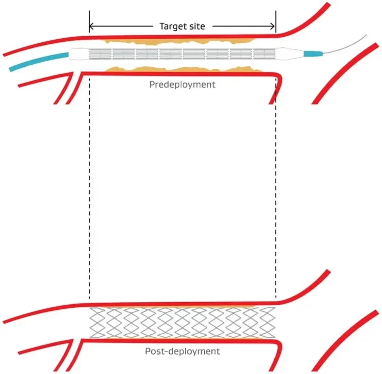 Diagram of the VBX