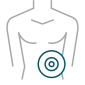 Icon specific to ventral hernia area of patients to emphasize that SYNECOR has a <1% recurrence rate in VHWG 1 and 2 patients.